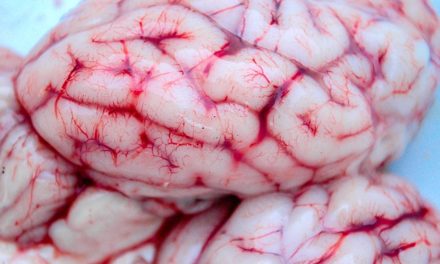Anatomia: il nervo sciatico brevemente delineato